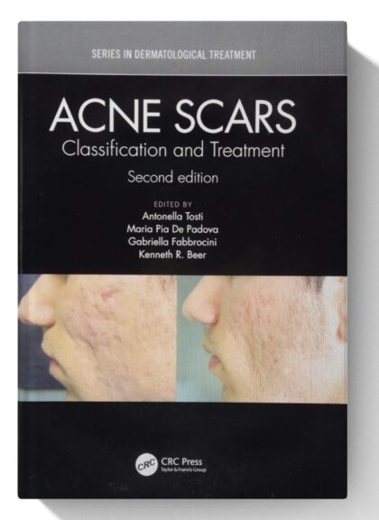 Acne Scars: Classification and Treatment, Second Edition (Series in Dermatological Treatment)