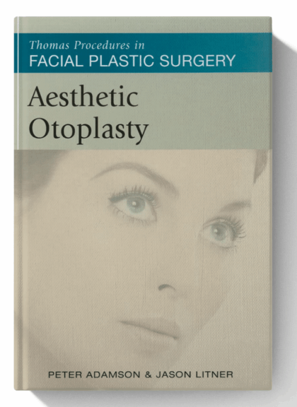 Aesthetic Otoplasty (Thomas Procedures in Facial Plastic Surgery)