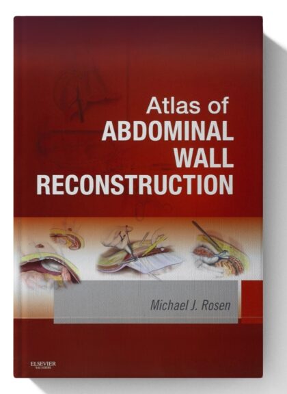 Atlas of Abdominal Wall Reconstruction: Expert Consult - Online