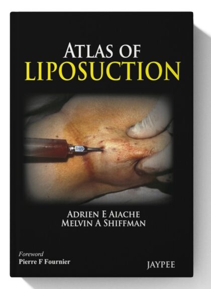 Atlas of Liposuction
