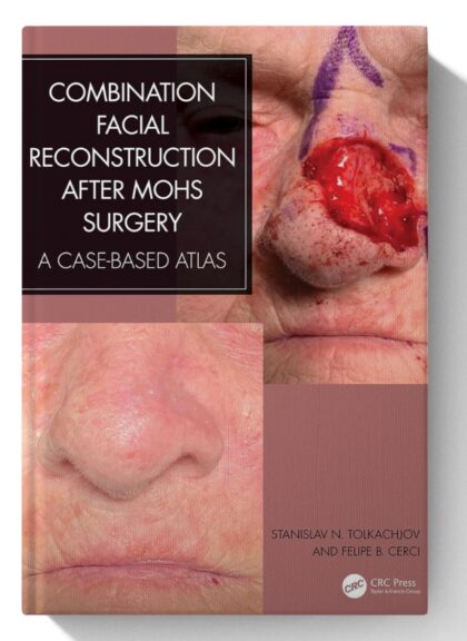 Combination Facial Reconstruction after Mohs Surgery: A Case Based Atlas