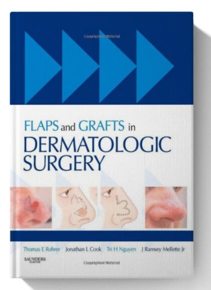 Flaps and Grafts in Dermatologic Surgery
