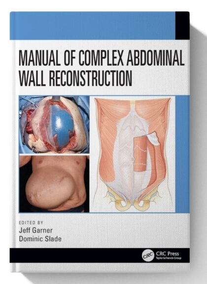 Manual of Complex Abdominal Wall Reconstruction