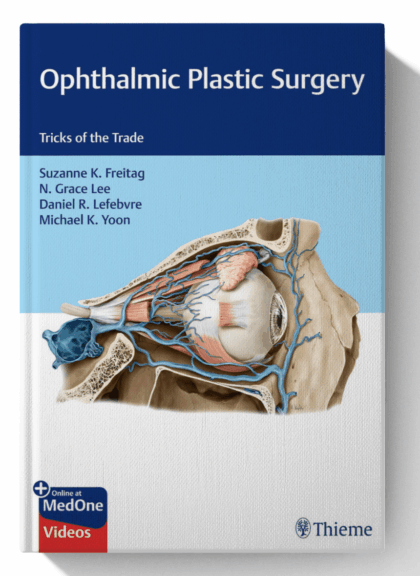 Ophthalmic Plastic Surgery: Tricks of the Trade
