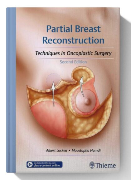Partial Breast Reconstruction: Techniques in Oncoplastic Surgery