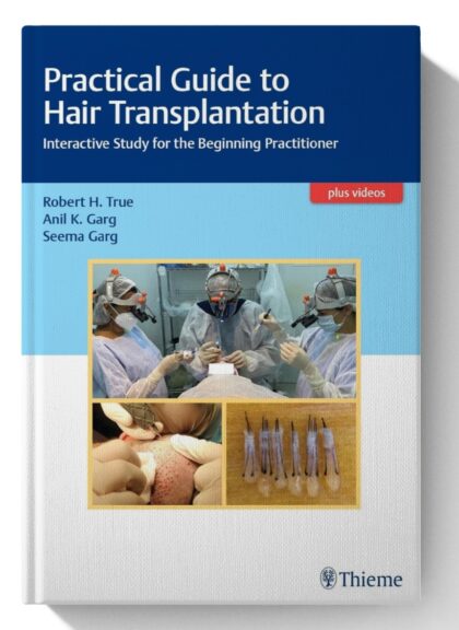 Practical Guide to Hair Transplantation: Interactive Study for the Beginning Practitioner