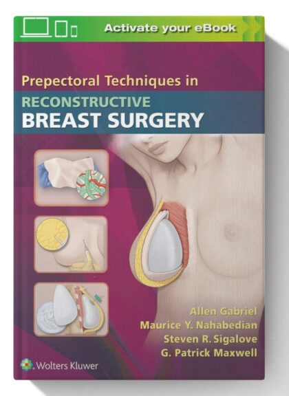 Prepectoral Techniques in Reconstructive Breast Surgery