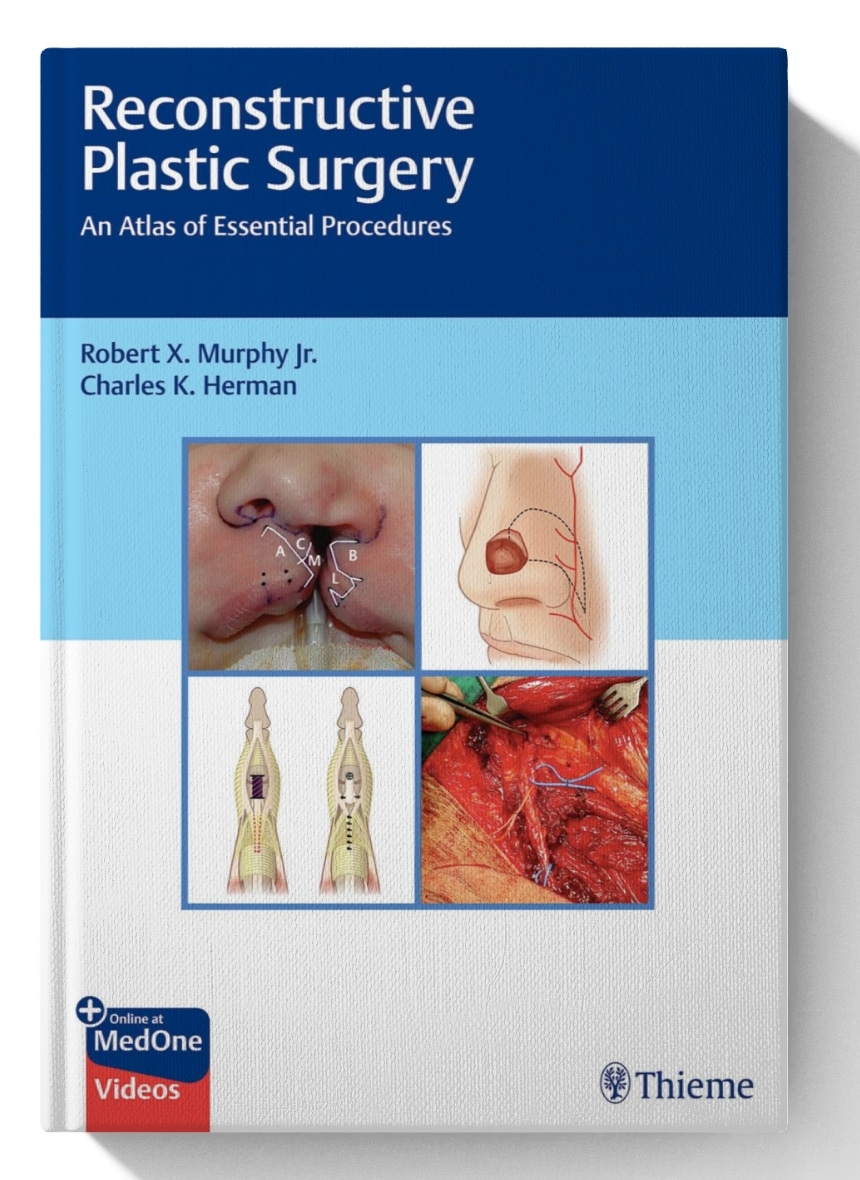 Reconstructive Plastic Surgery: An Atlas of Essential Procedures
