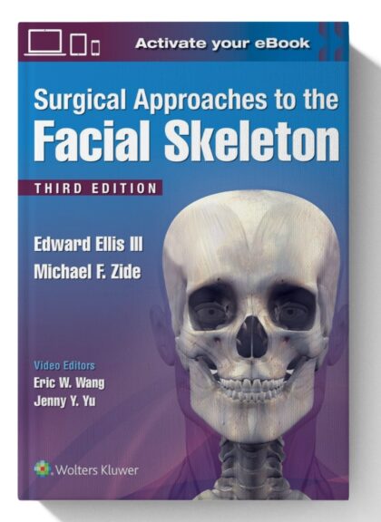 Surgical Approaches to the Facial Skeleton