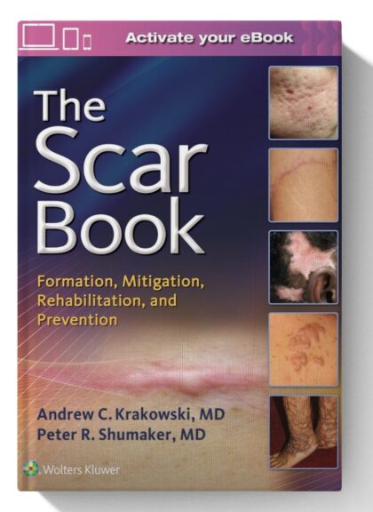 The Scar Book: Formation, Mitigation, Rehabilitation and Prevention
