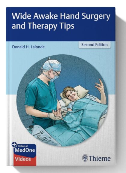 Wide Awake Hand Surgery and Therapy Tips