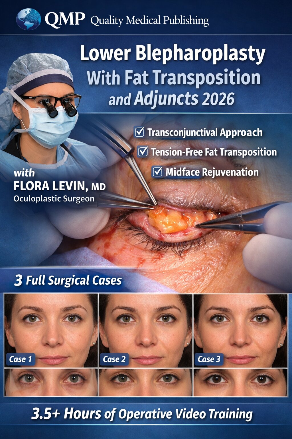 Lower Blepharoplasty With Fat Transposition and Adjuncts 2026 - Image 2